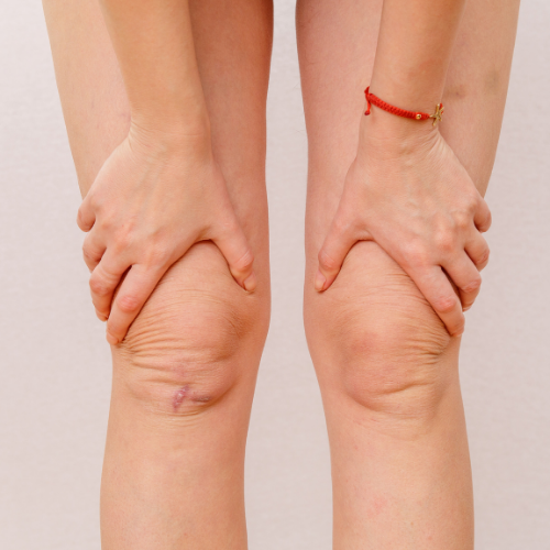 Half Leg including Knee - Microneedling